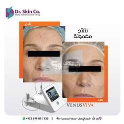 شركة Dr skin للأجهزة التجميلية