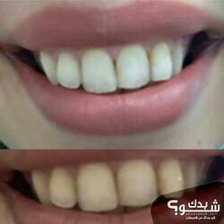 I-Smile Dental Clinic الدكتور بهاء الزغير و الدكتورة شفاء الشمالي 