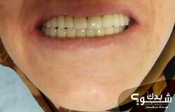 I-Smile Dental Clinic الدكتور بهاء الزغير و الدكتورة شفاء الشمالي 