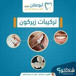 عيادات ابو علان لطب الاسنان 