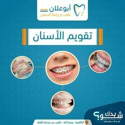 عيادات ابو علان لطب الاسنان 